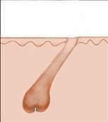 Epilazione 2
