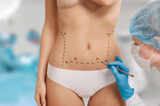 Cirurgião Plástico para Lipoaspiração em São Paulo: Como Escolher o Melhor Profissional Cirurgião Plástico para Lipoaspiração em São Paulo: Como Escolher o Melhor Profissional