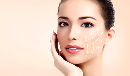 Fios de Sutura para Lifting Facial Fios de Sutura para Lifting Facial