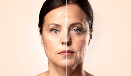 Harmonização facial e MD codes Harmonização facial e MD codes