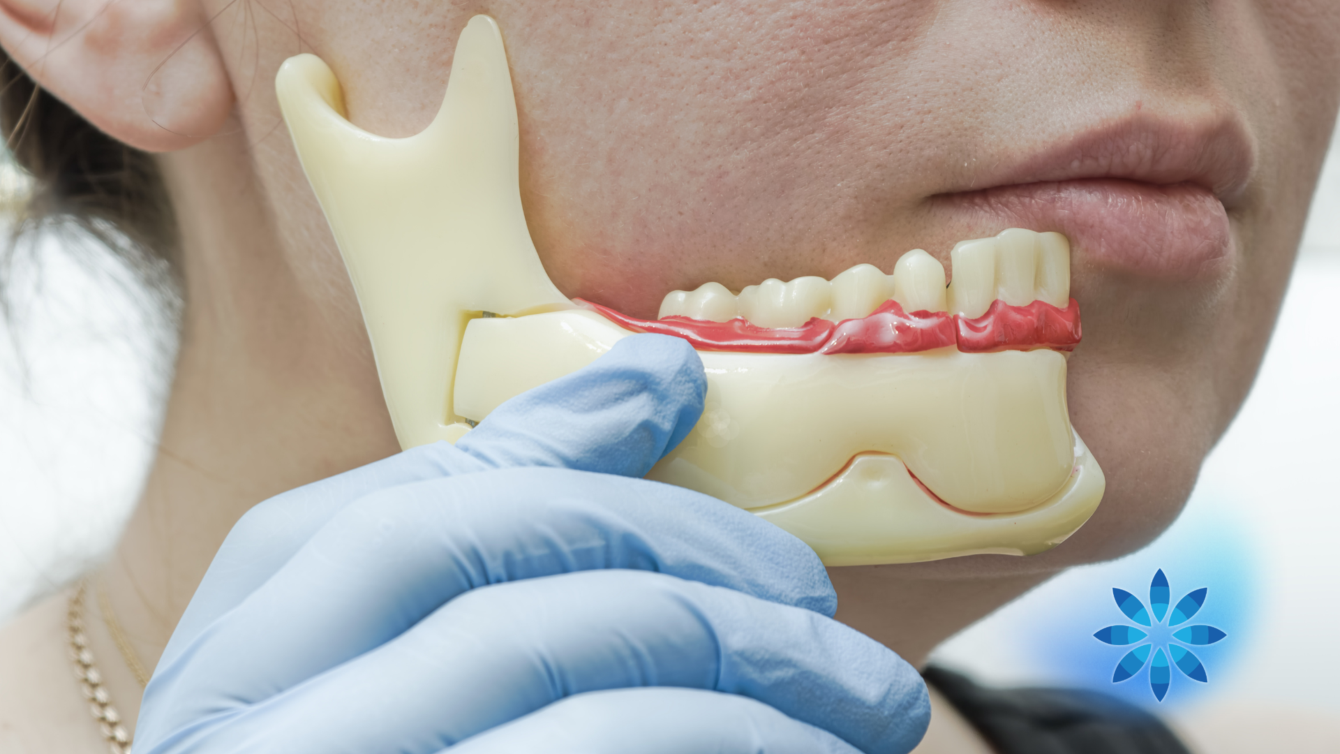 Gloved hand holding a dental model of teeth and gums near a person’s mouth