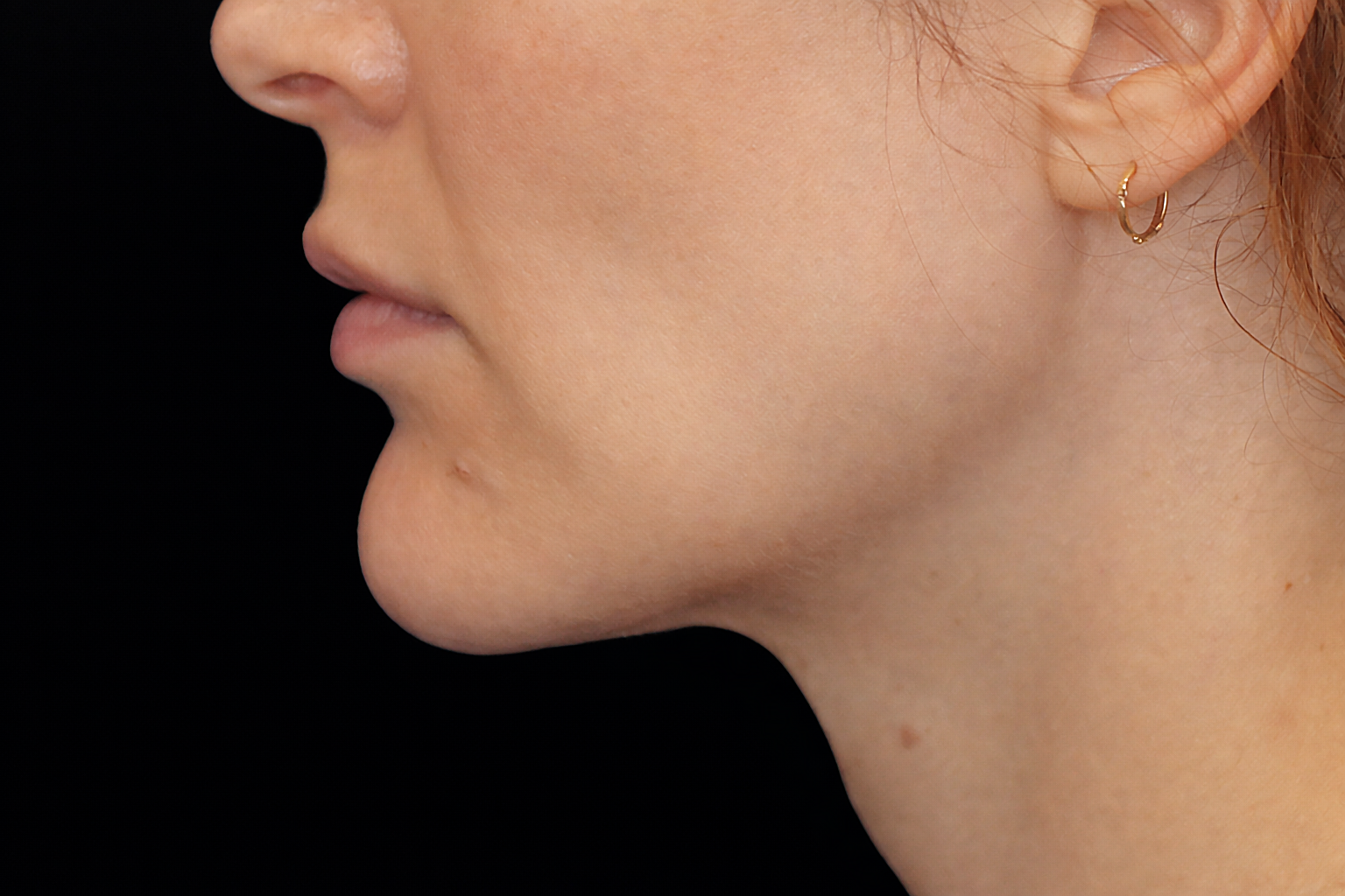 Side profile of a person's face, highlighting their jawline and chin.