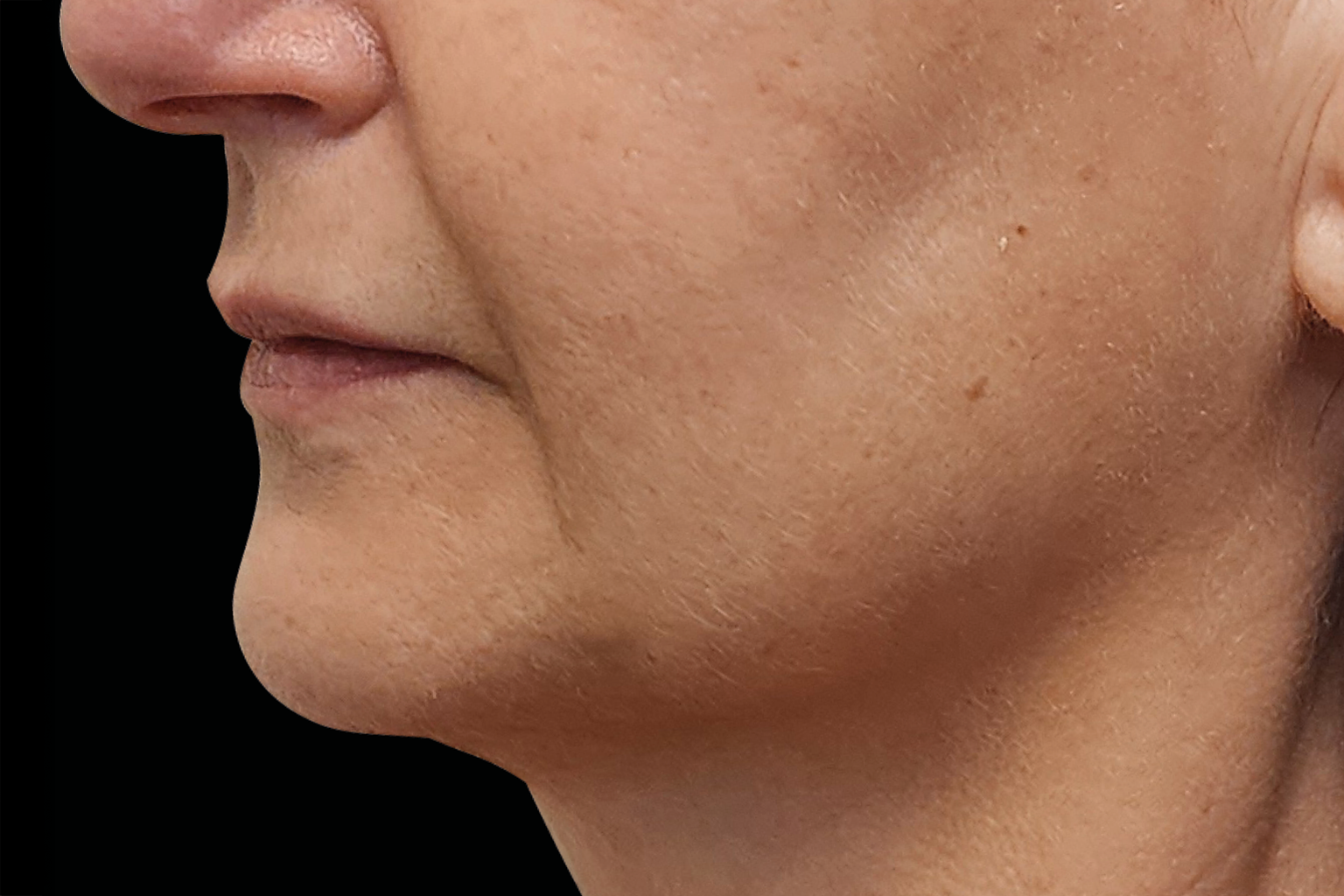 Side profile of a person’s face against a black background, showing the nose, lips, chin, and neck