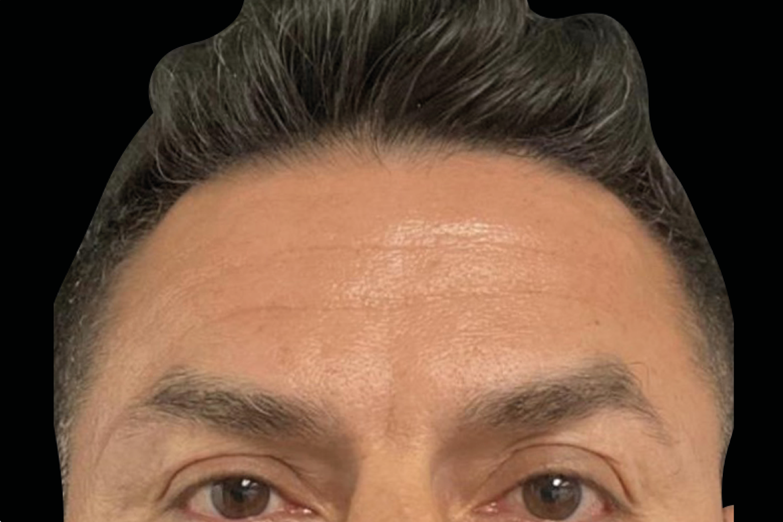 Close-up of a person's forehead, eyes, and styled dark hair against a black background
