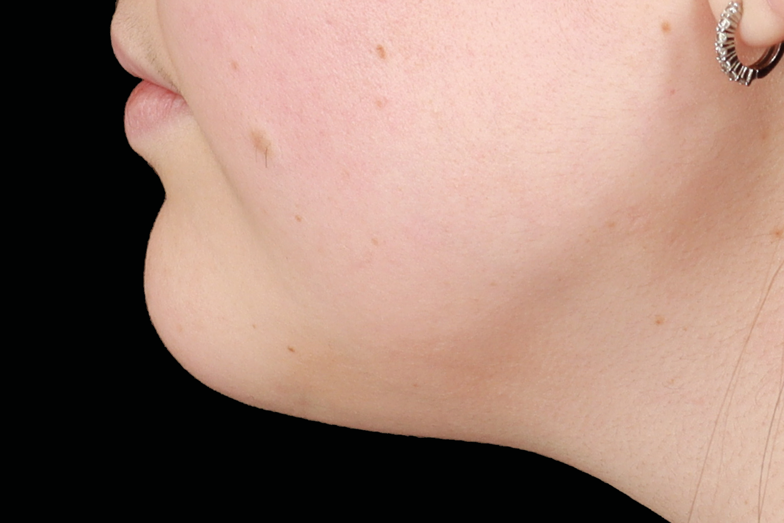 Side profile of a person’s jaw and chin against a black background