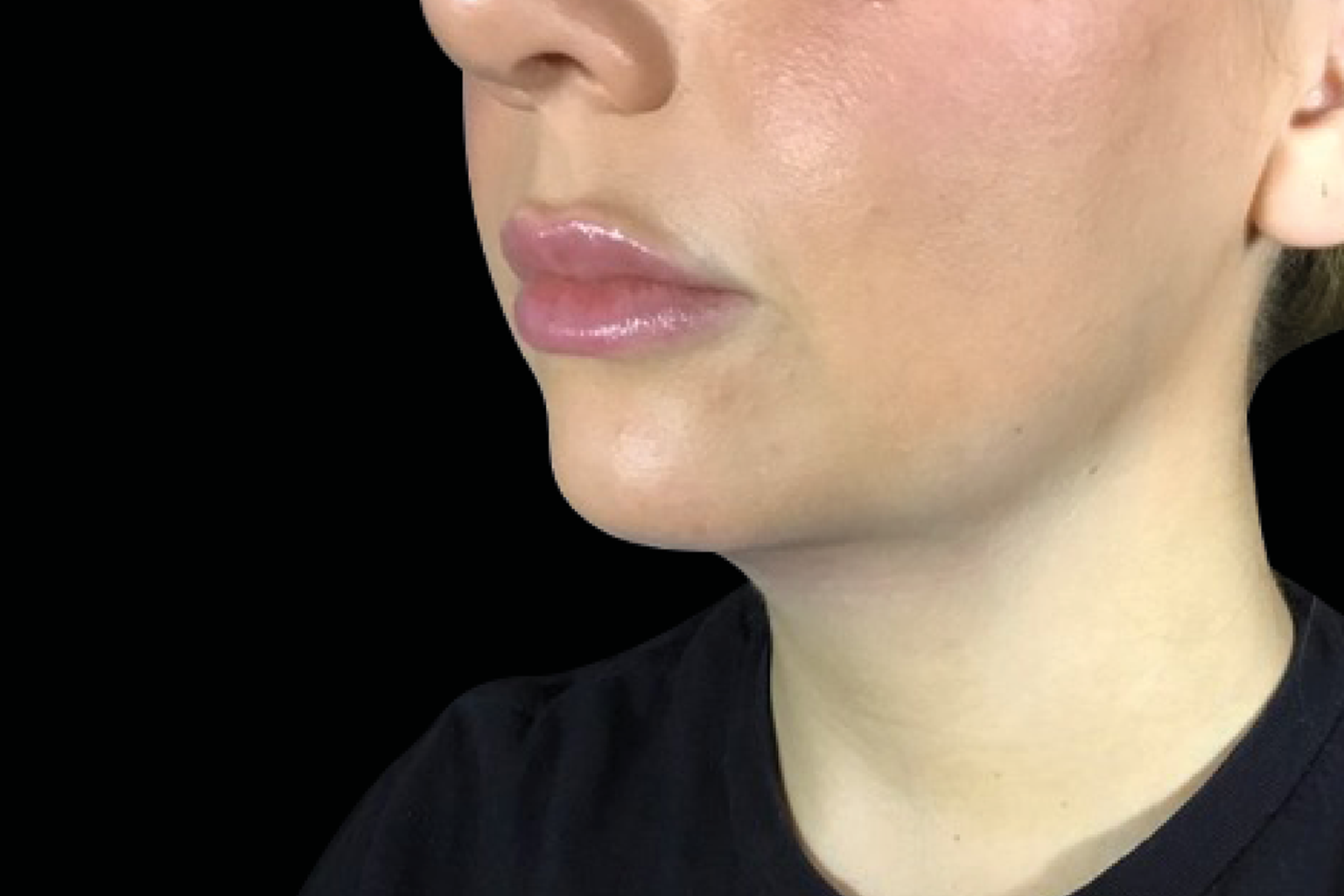 Side profile of a person’s face with pink lips against a black background