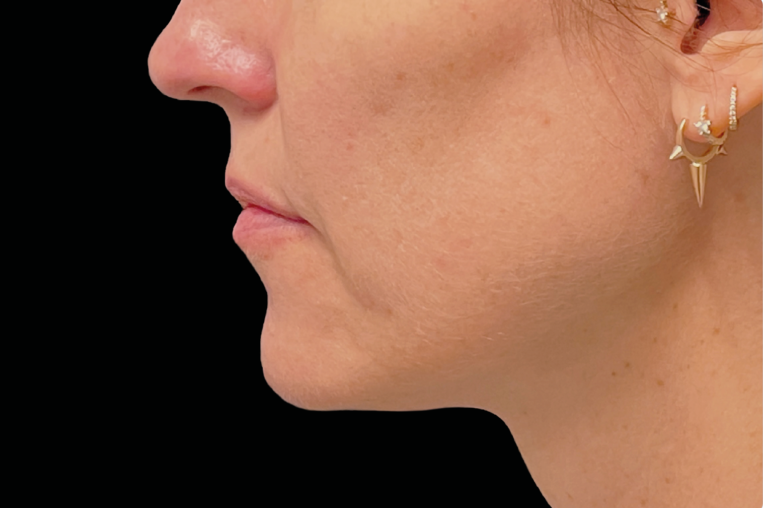 Side profile of a person’s face and neck with a nose ring and gold earrings against a black background