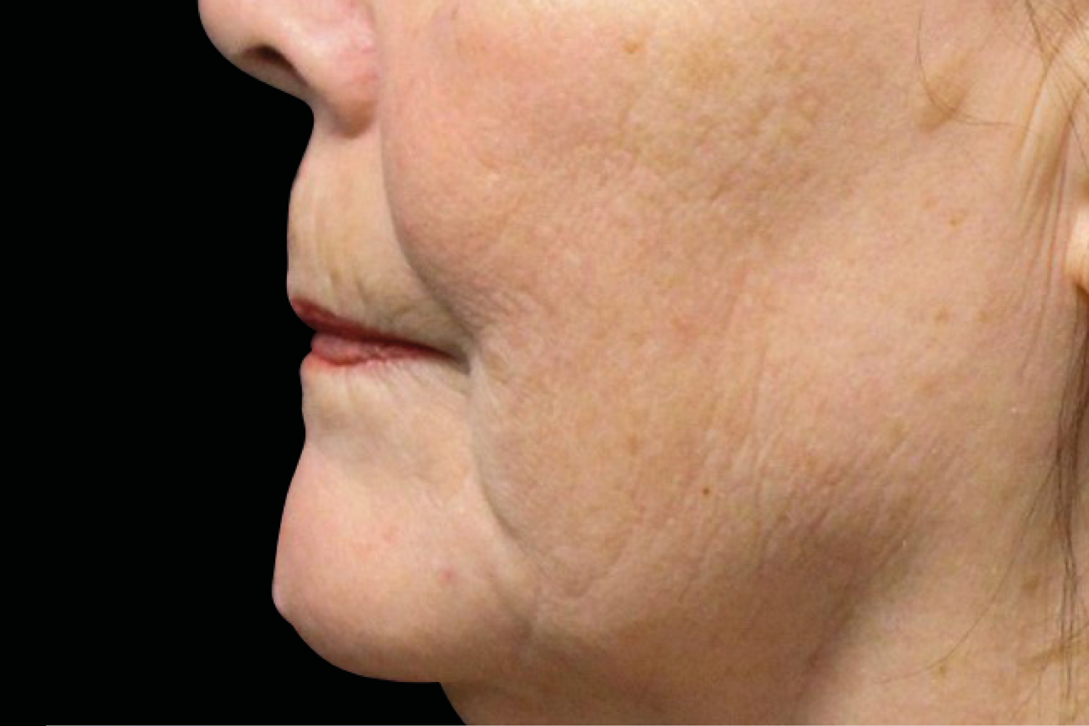 Side profile close-up of a person’s lower face and neck against a black background.