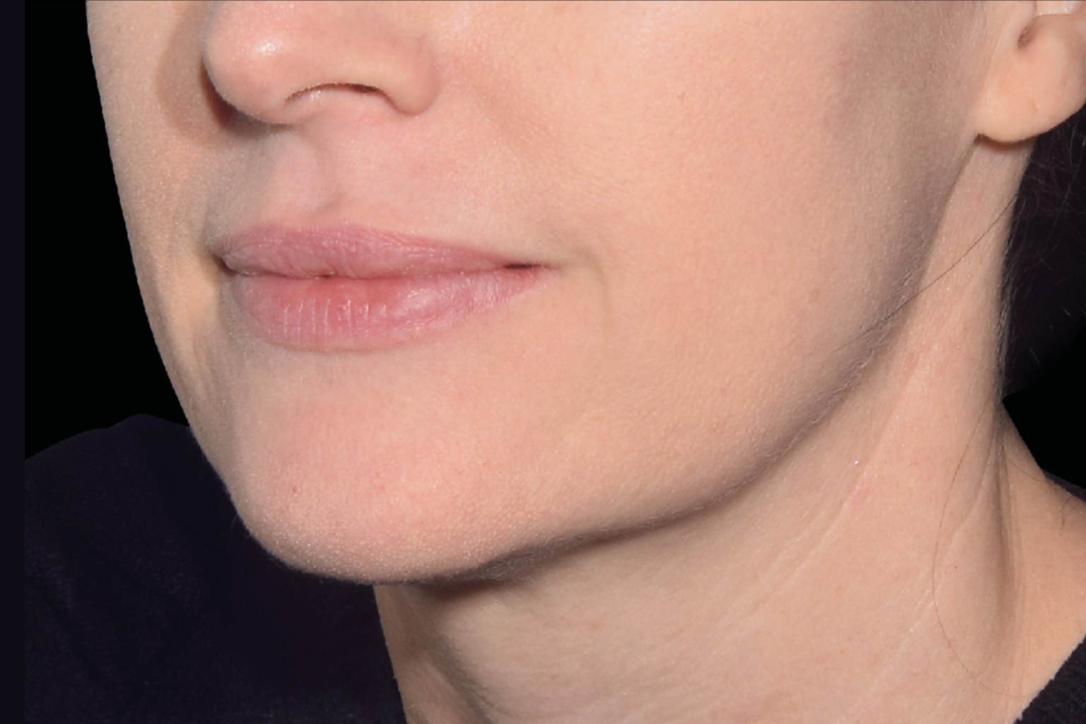 Close-up of a person’s lower face and neck with a visible jawline and slight smile