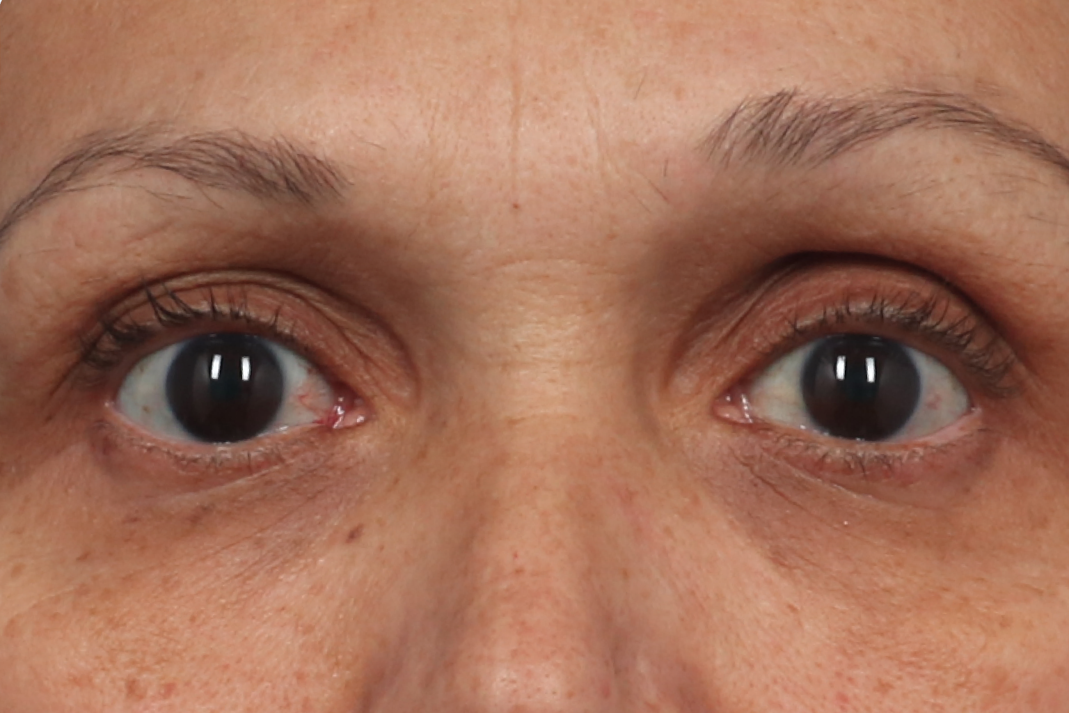 Close-up of a person’s eyes and upper face, looking forward, with brown irises and light skin.