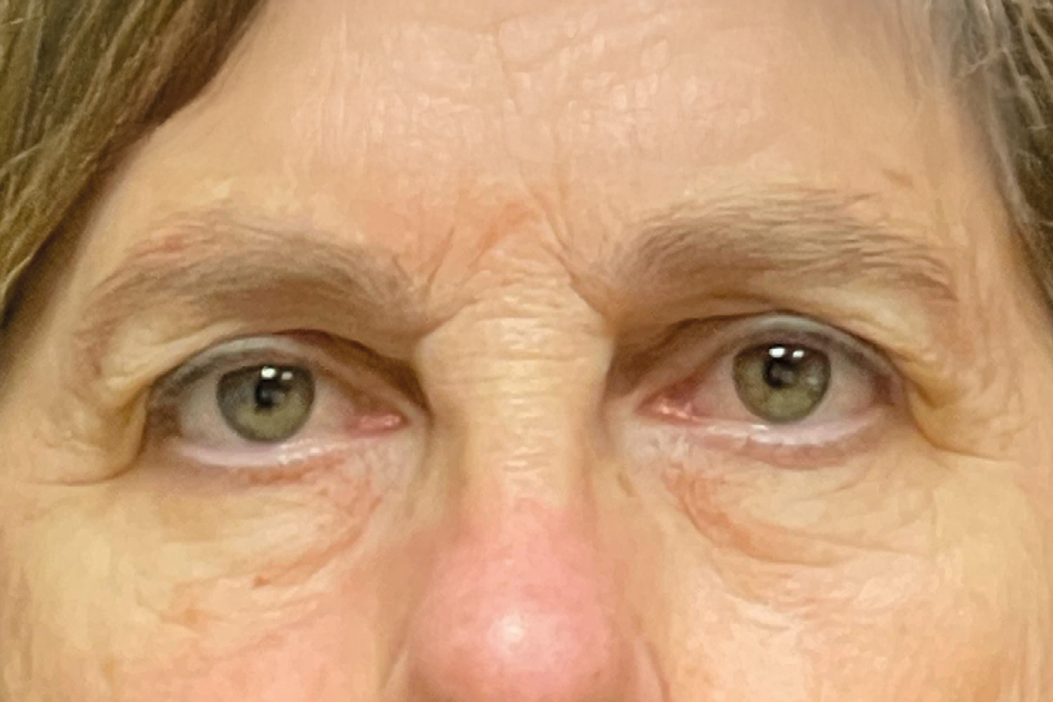 Close-up of a person’s eyes and nose, with a neutral expression.
