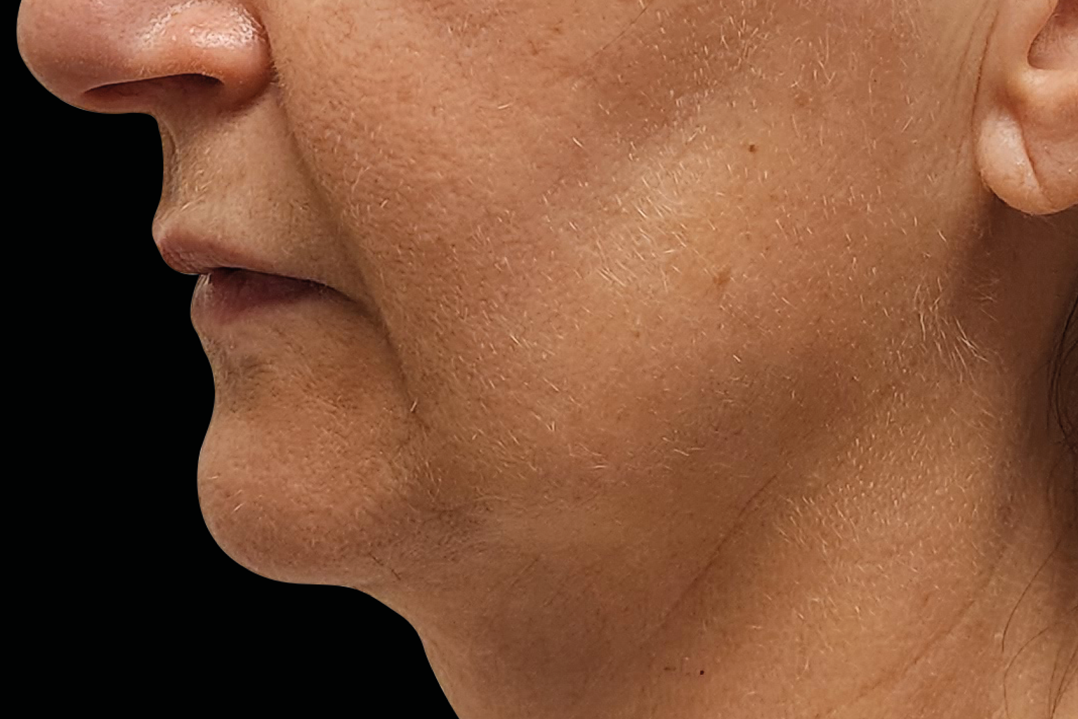 Close-up side profile of a person’s face and neck against a black background