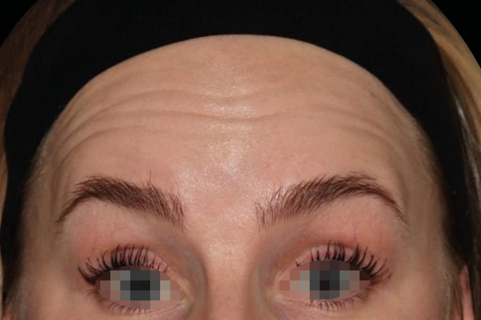 Close-up of a person’s eyes and forehead with long lashes, framed by a black headband