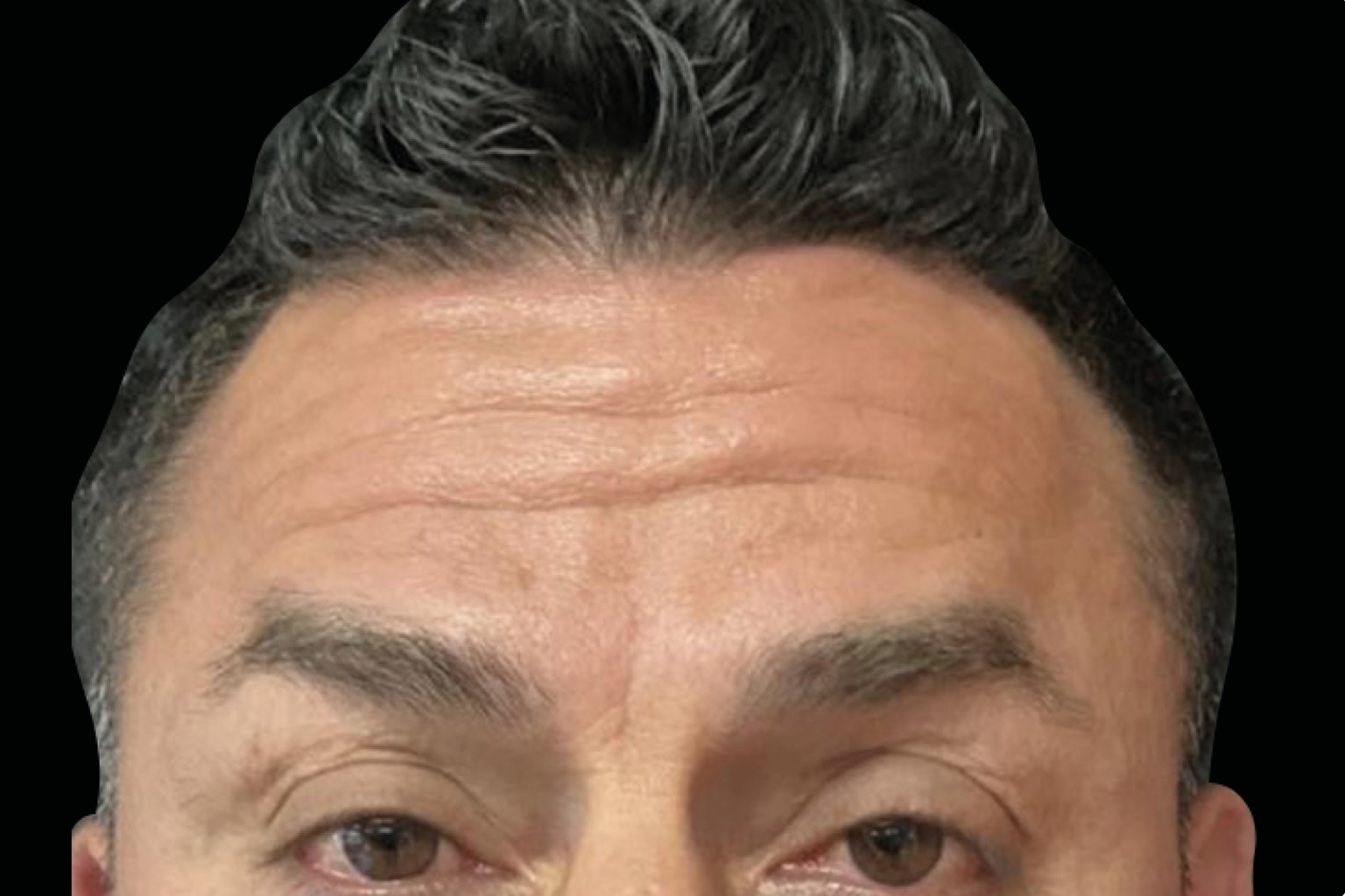 Close-up of a person’s forehead, eyes, and dark hair against a black background
