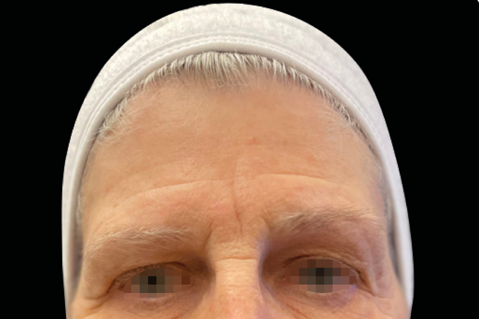 Close-up of a forehead and eyes with a white headband or cap, neutral expression