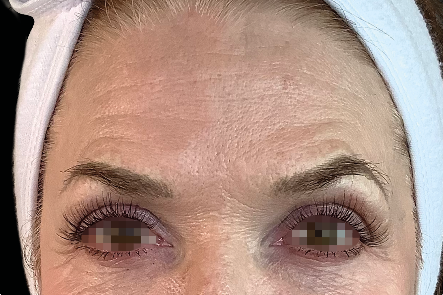 Close-up of a person’s eyes and forehead with white towel or headband, looking straight ahead