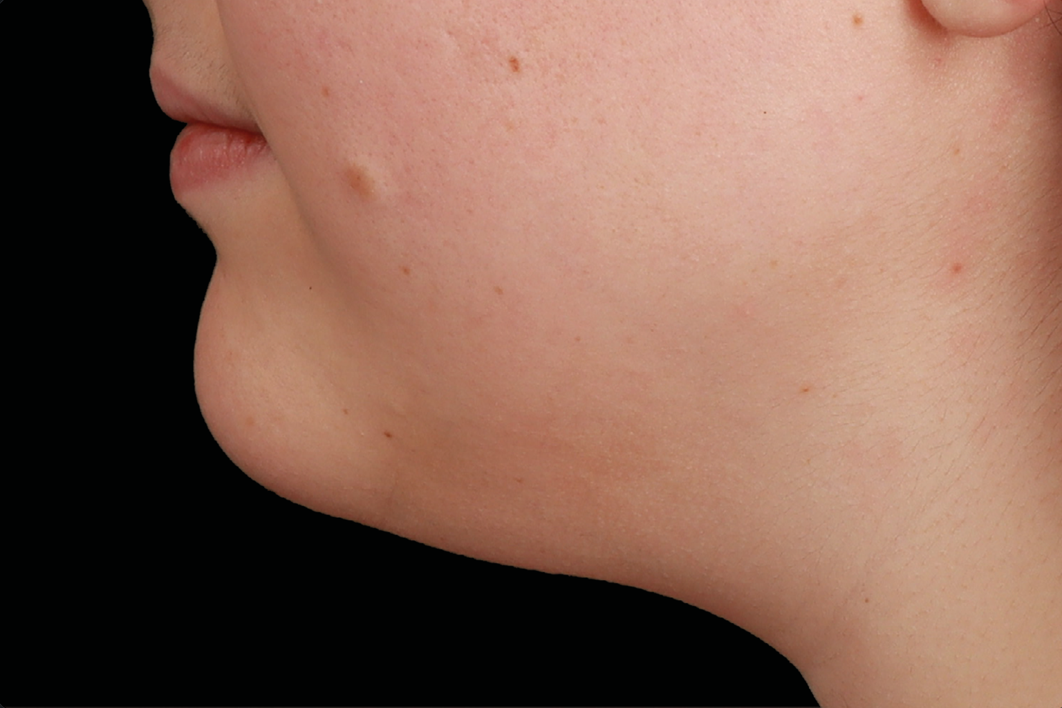 Close-up side profile of a person’s chin and lower face against a black background