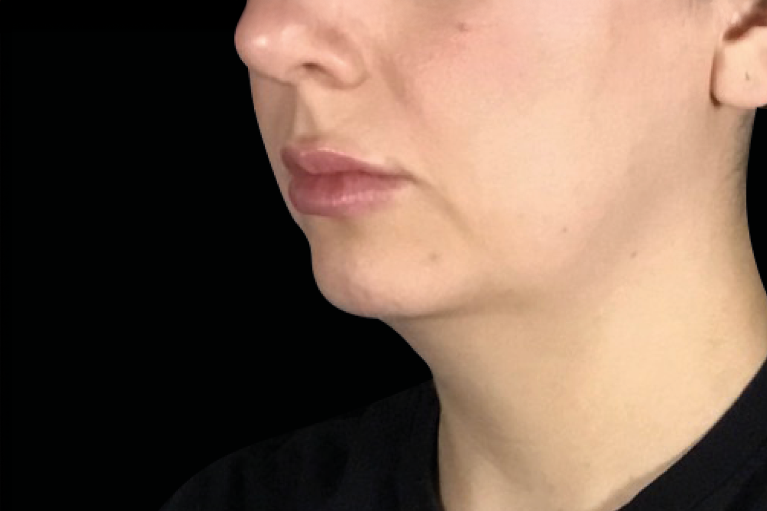 Close-up side profile of a person’s lower face and neck against a black background