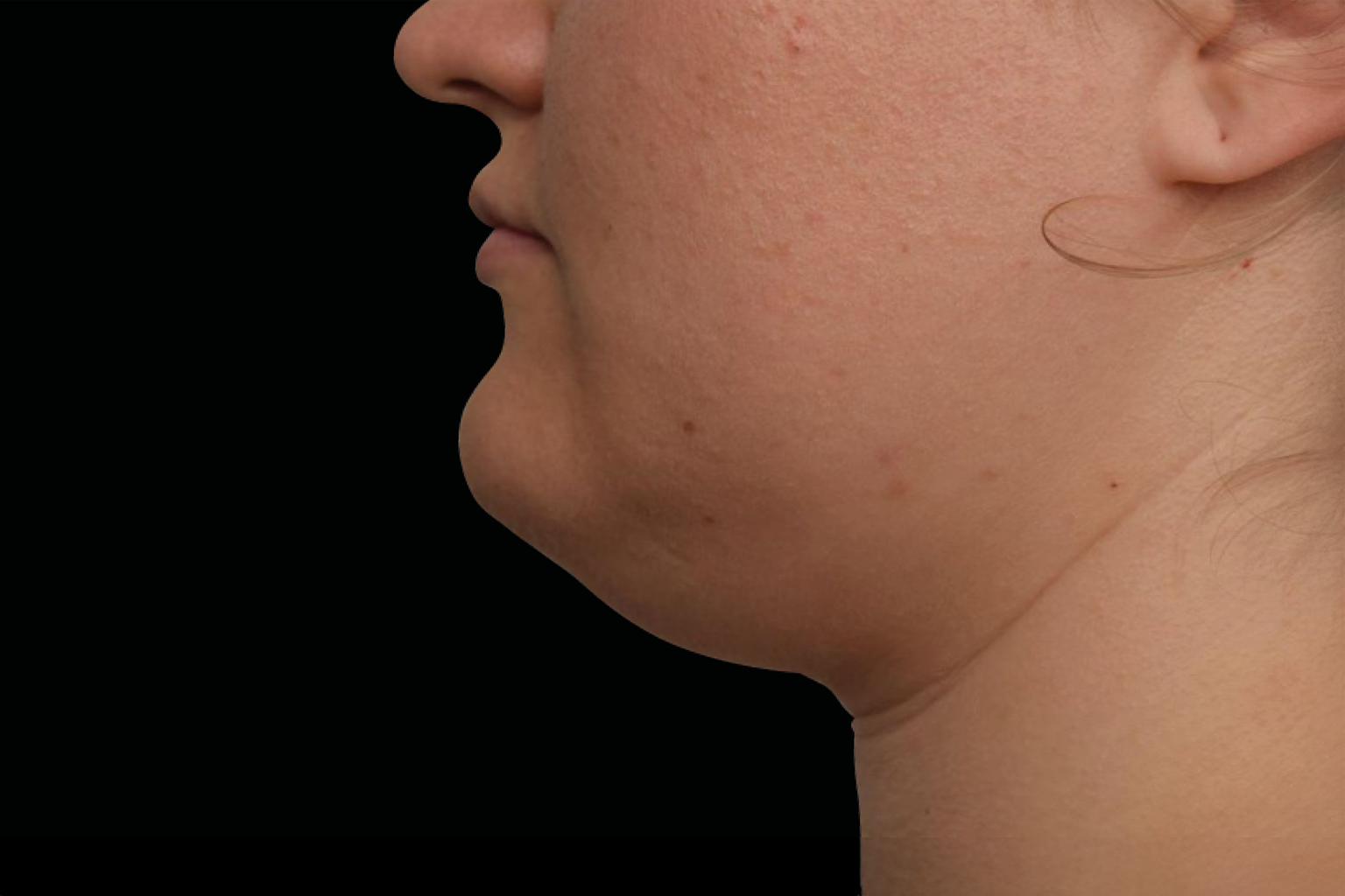 Side profile of a person’s face and neck against a black background.