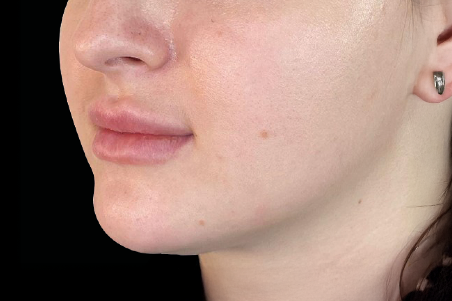 Close-up side profile of a person’s face with clear skin and a small ear piercing against a black background