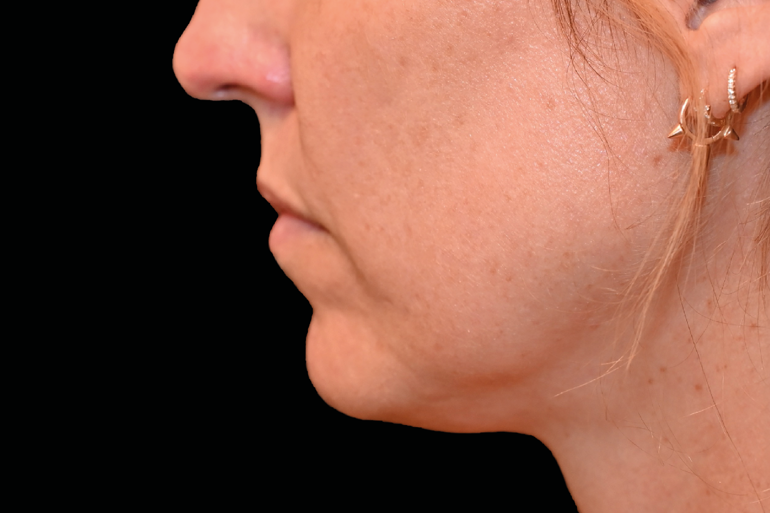 Side profile of a person’s face with a lower jawline visible against a black background.