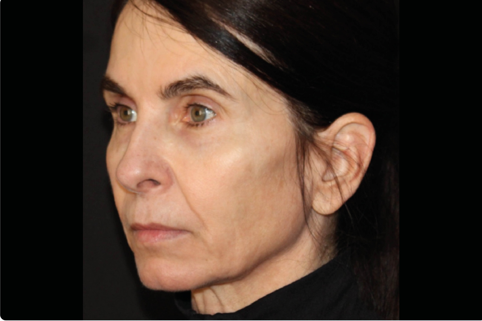 Close-up side profile of a person with dark hair, looking ahead against a black background