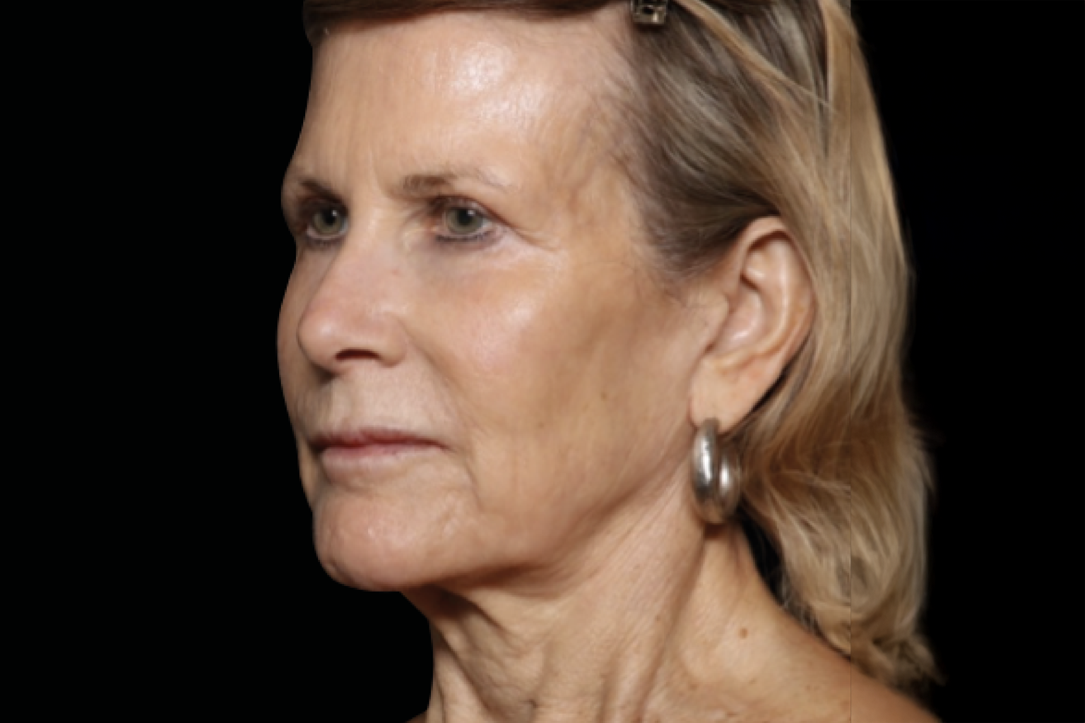 Profile portrait of a woman with short blonde hair against a black background