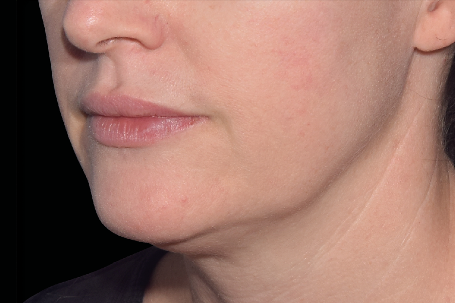 Close-up of a person’s lower face and jawline against a black background.