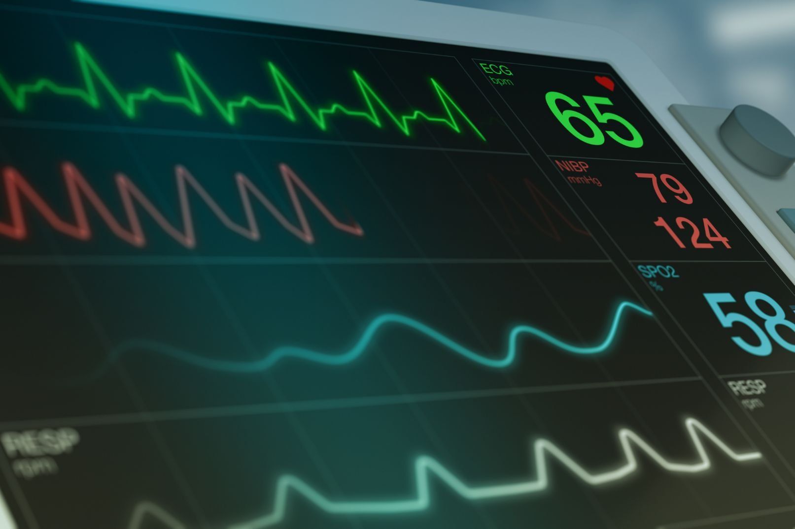 Vital signs monitor displaying fluctuating green and blue waveforms and numerical readouts.