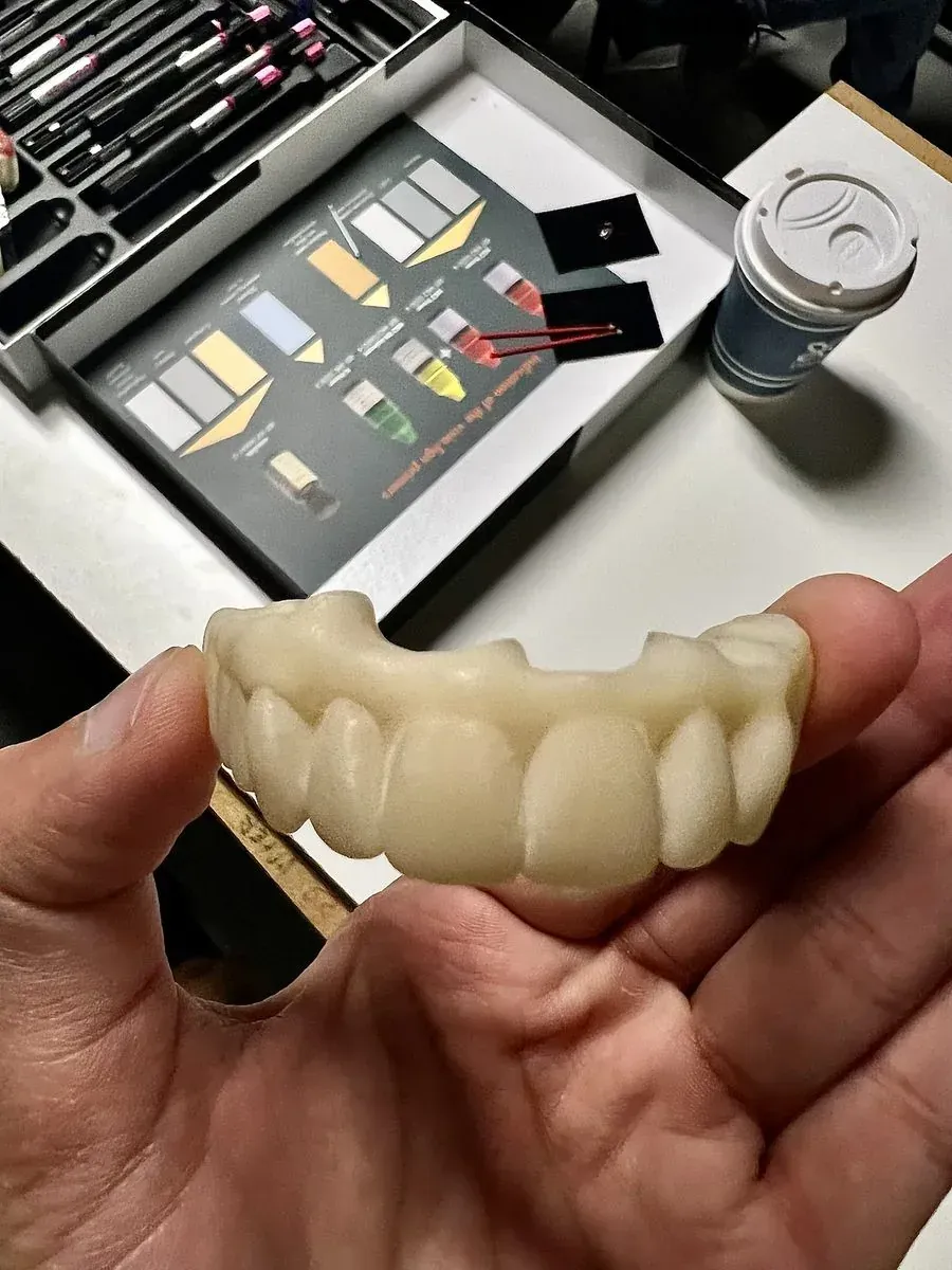 All-on-4 Implants