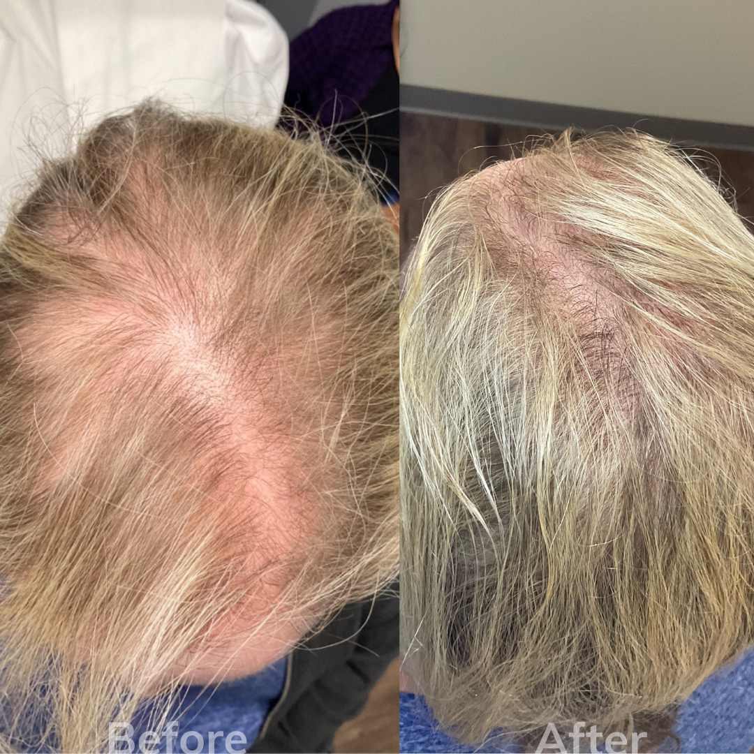 Cosmetic Laser Center San Marcos