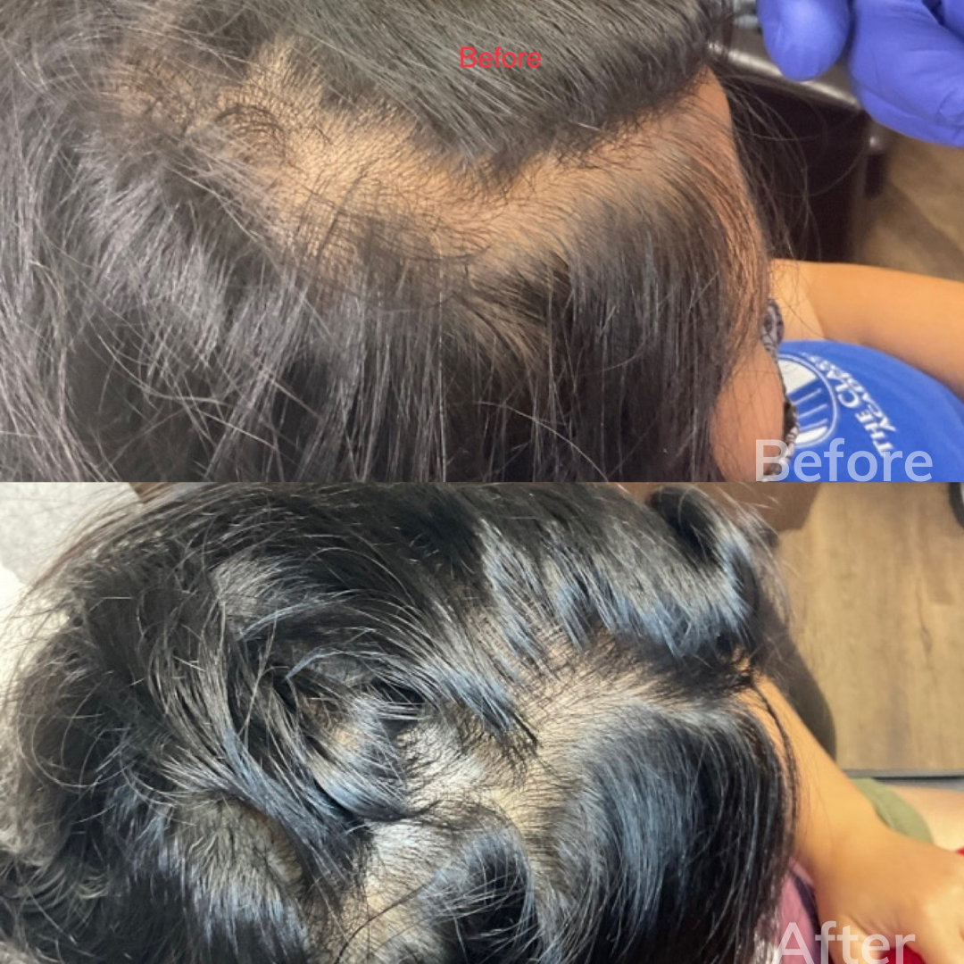 Skin Laser Clinic San Marcos