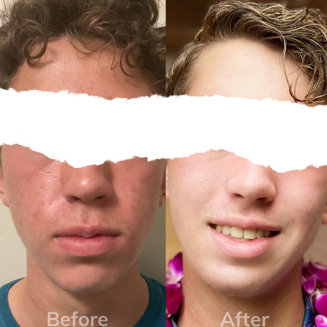 A before and after picture of a man 's face