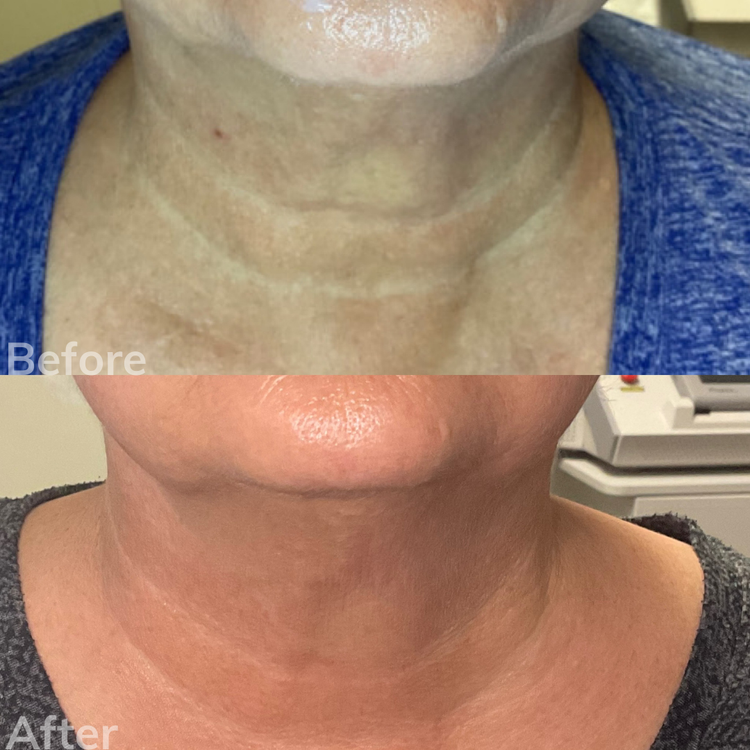 Laser Cosmetic Solutions San Marcos