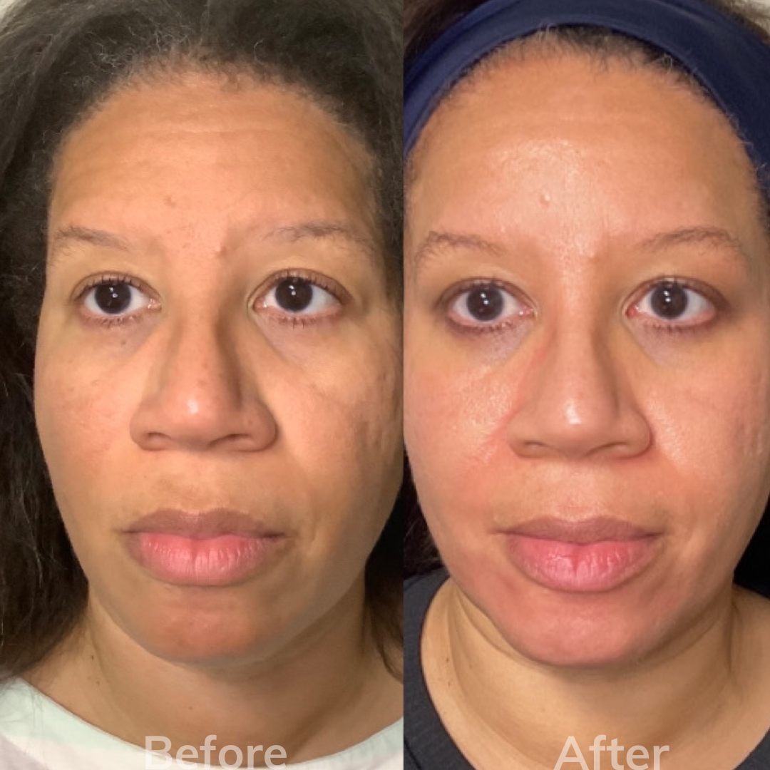 A before and after photo of a woman 's face