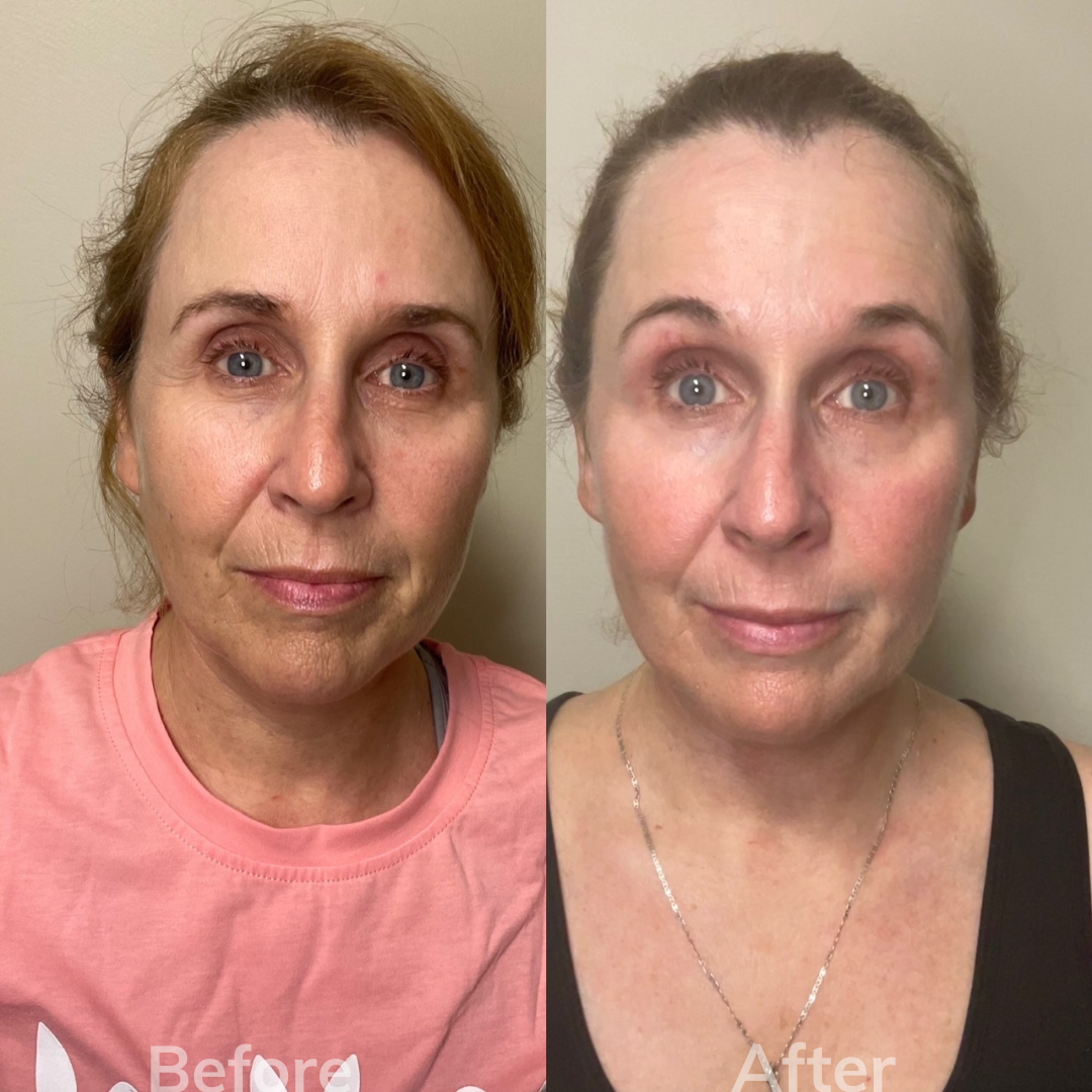 A before and after photo of a woman 's face