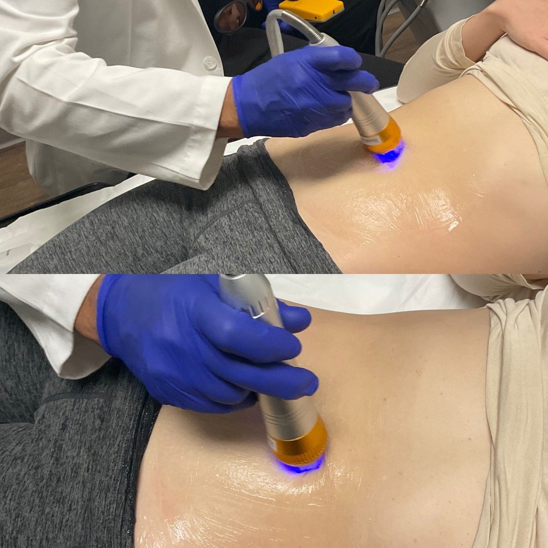 Best Dermal Fillers Carlsbad