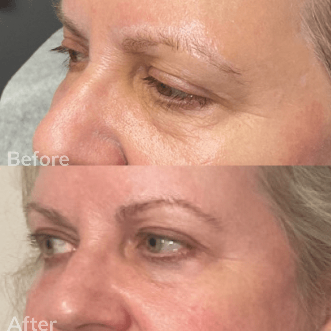 Local Botox Clinic