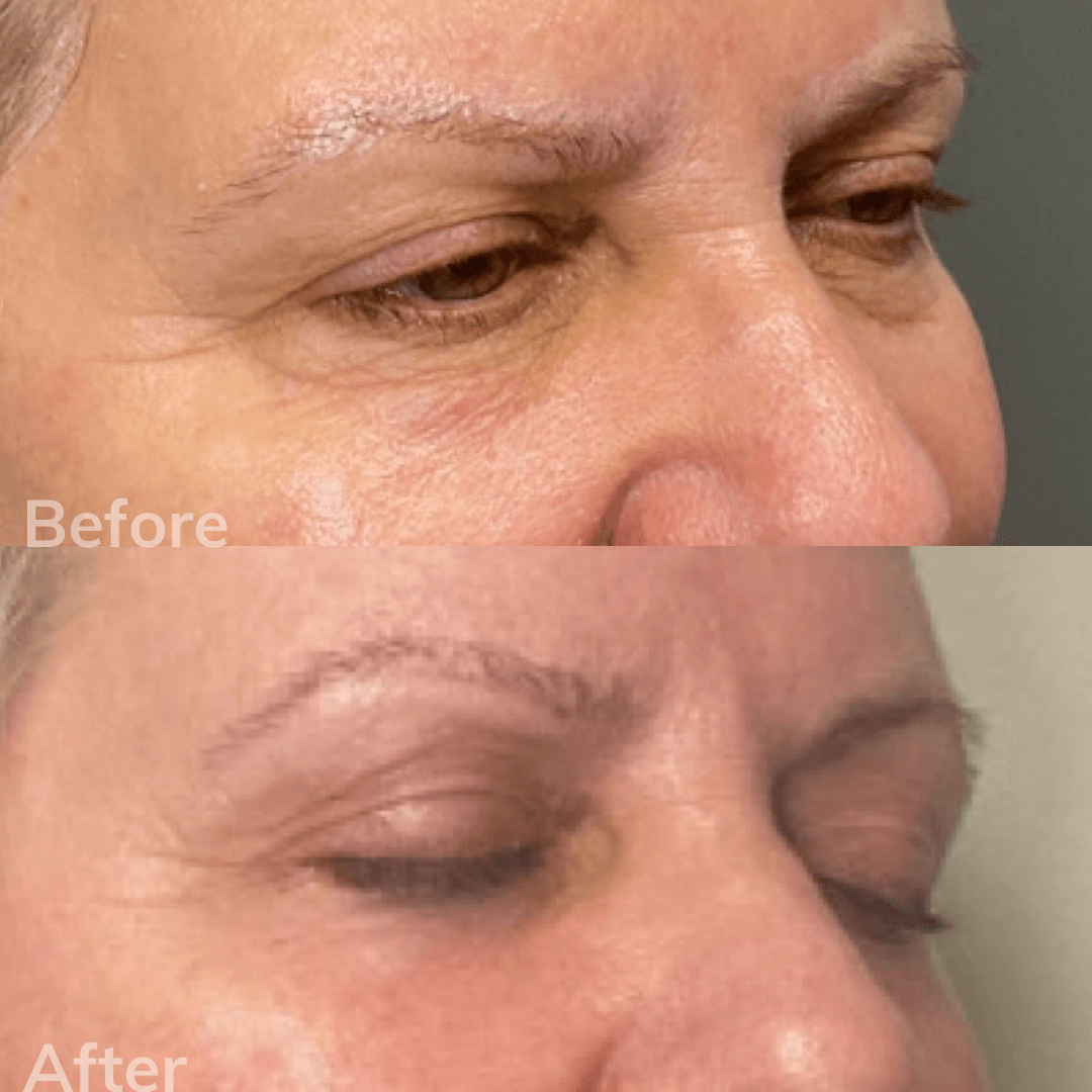 Cosmetic Laser Center Near Me