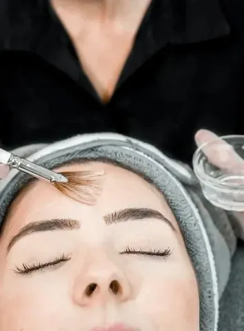 ongoing chemical peel session at studio med spa