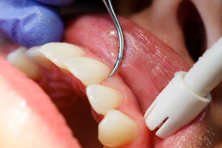 Endodonzia