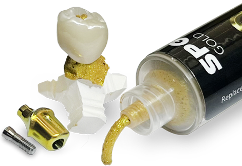 Implant crown lab services in Rexburg, ID Implant crown lab services in Rexburg, ID