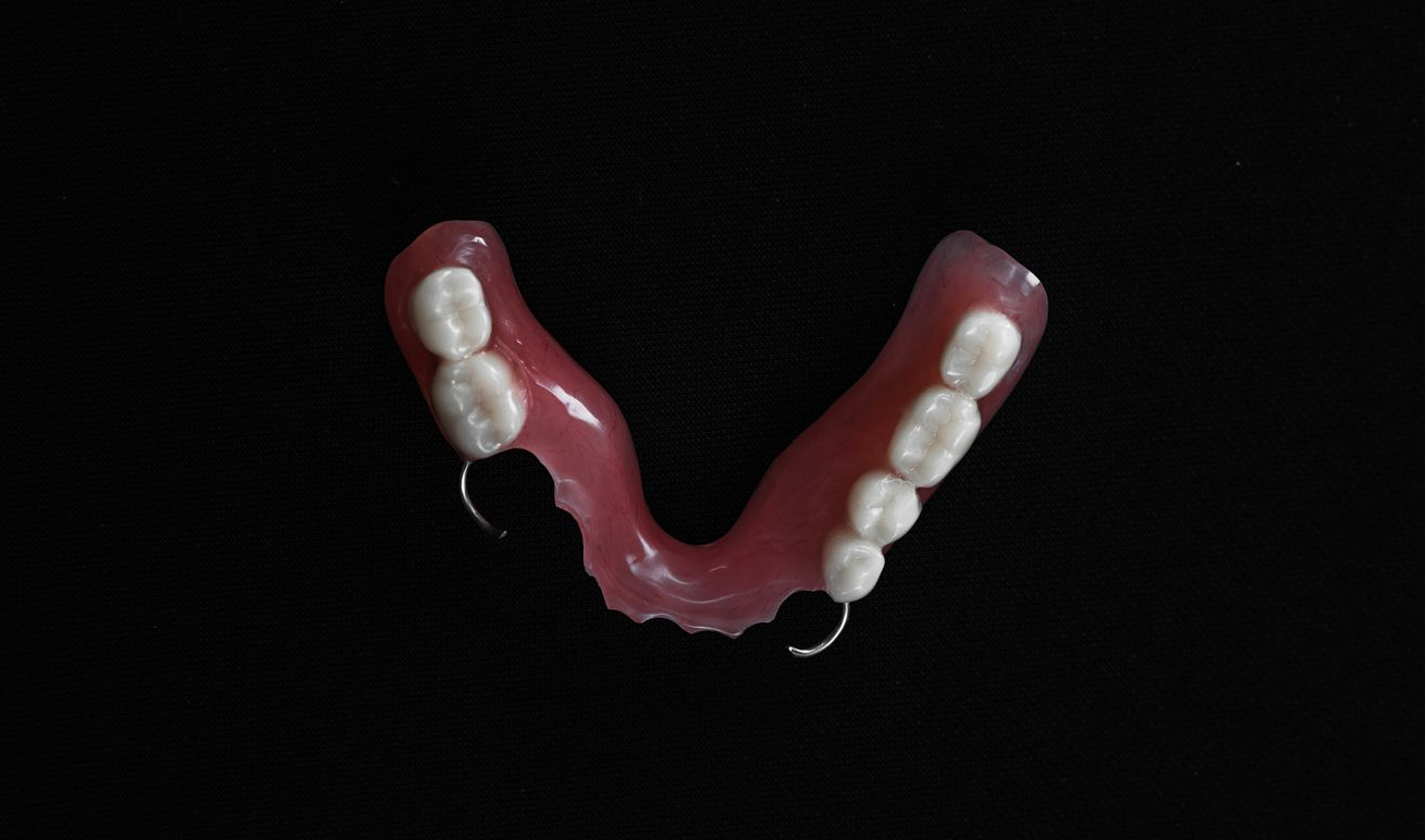 Partial dental denture at McMahon Dental with white teeth and pink base, on black background.