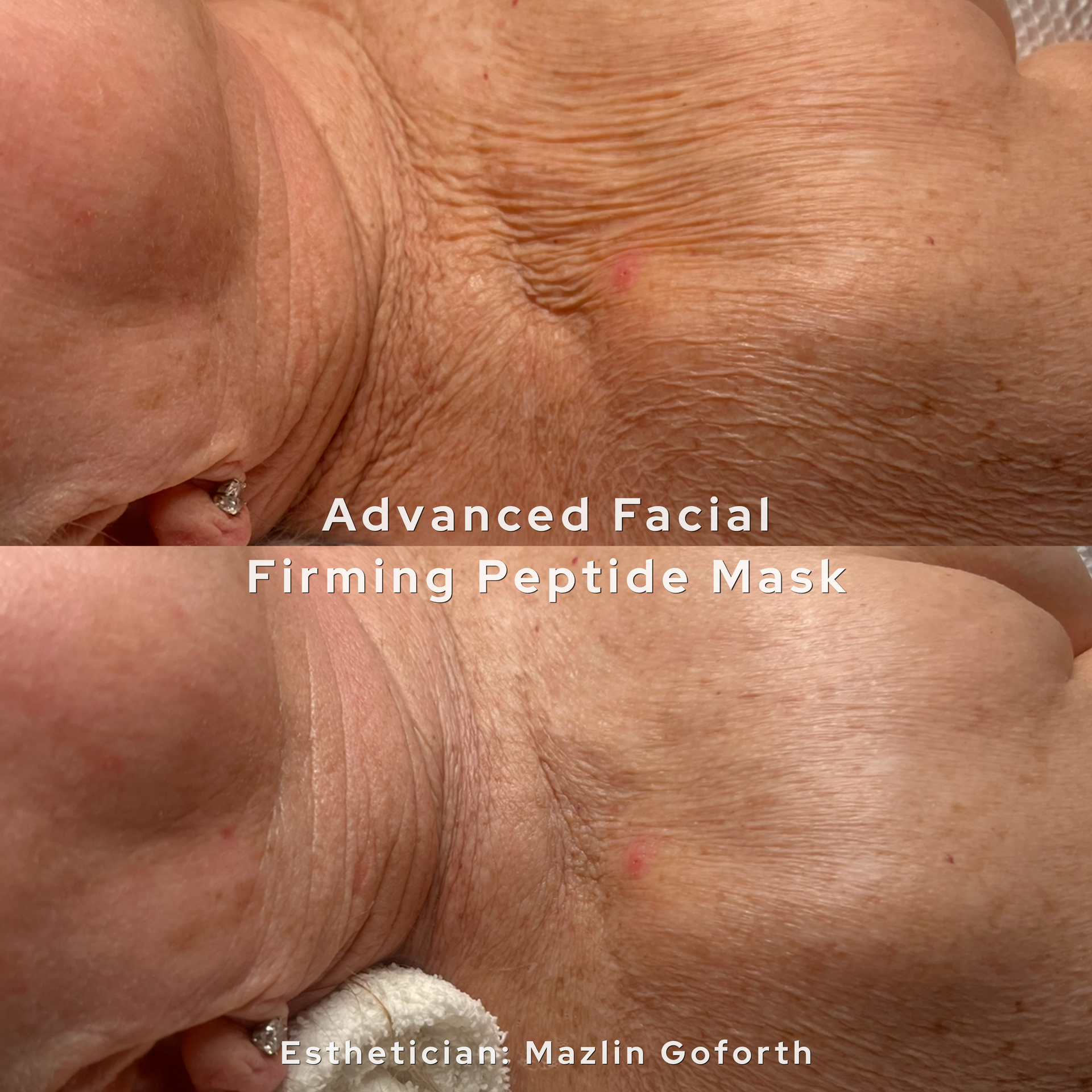 Close-up of a face with cream applied, overlaid with the text “Advanced Facial Firming Peptide Mask.”