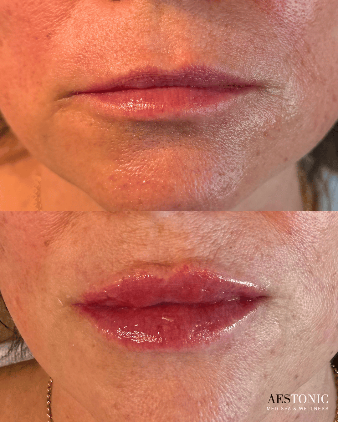 Close-up of lips before and after glossy red lipstick application.