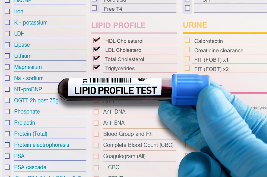 Cholesterol Testing