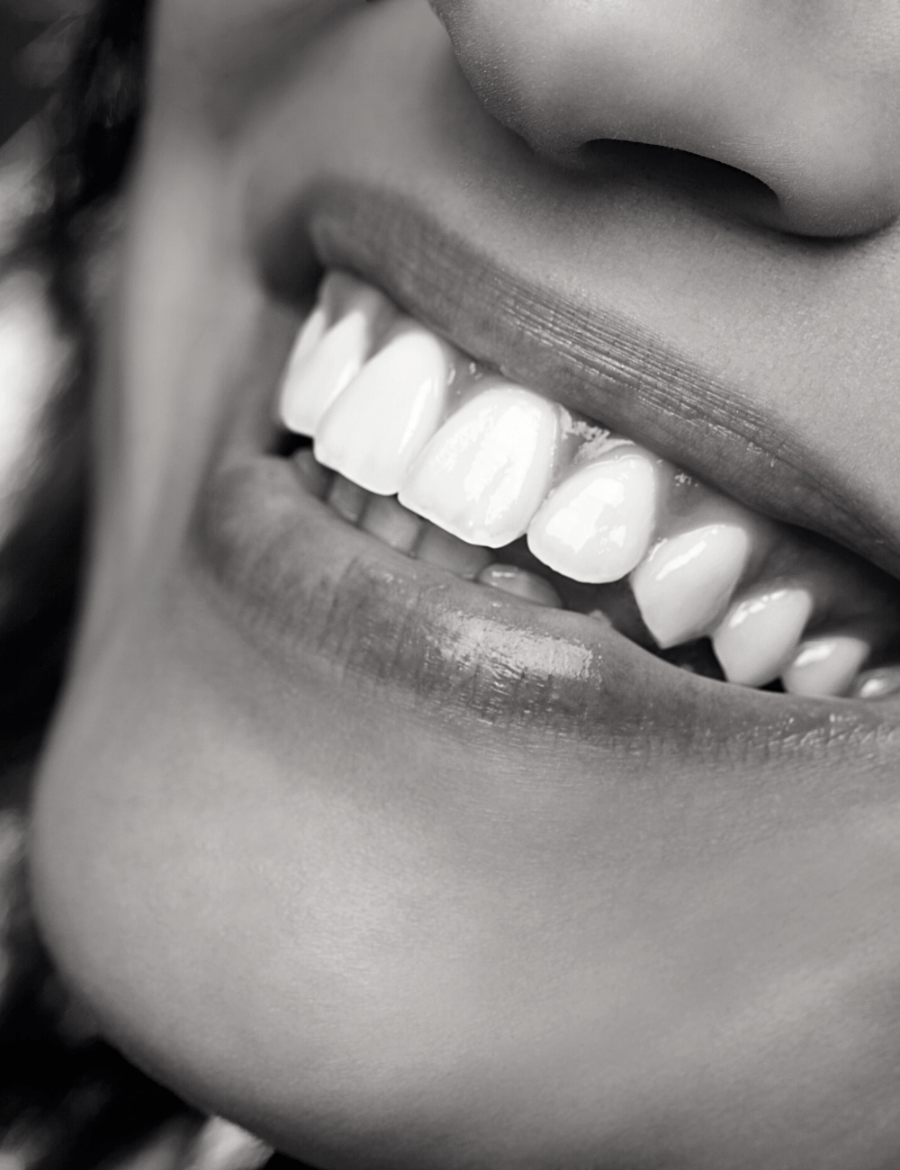 Woman with a dazzling white smile | Visit the best dentist in Leawood 66209 for teeth whitening. Porcelain veneers