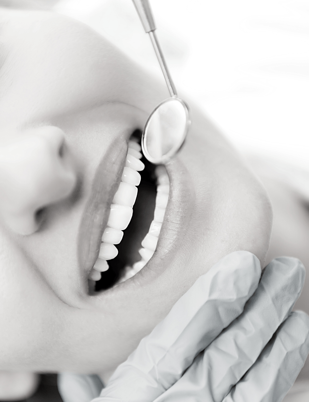 teeth whitening