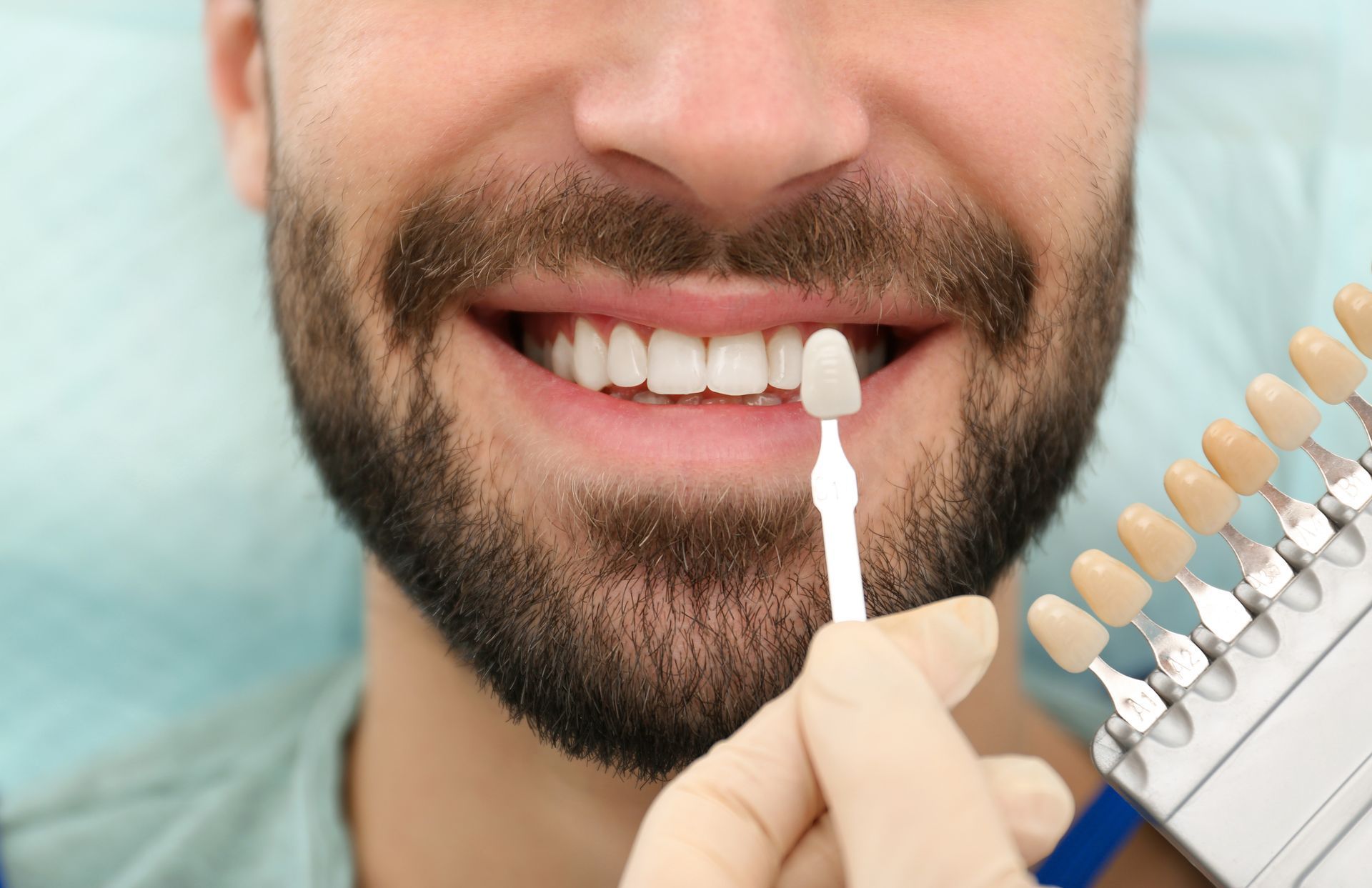 Man smiling while applying a tooth shade guide during a dental whitening consultation