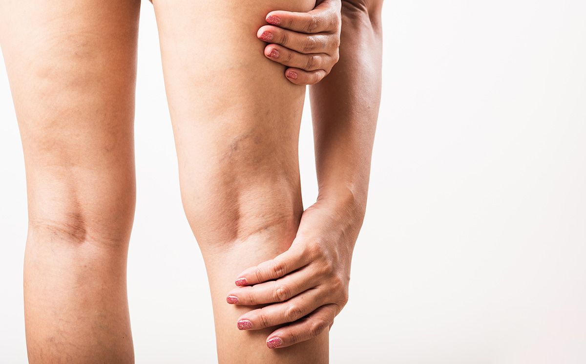a woman is holding her leg in pain